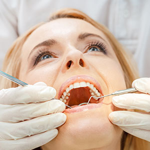 Souscrire une complémentaire santé dentaire